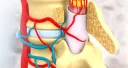 Spinal Cord Disorders