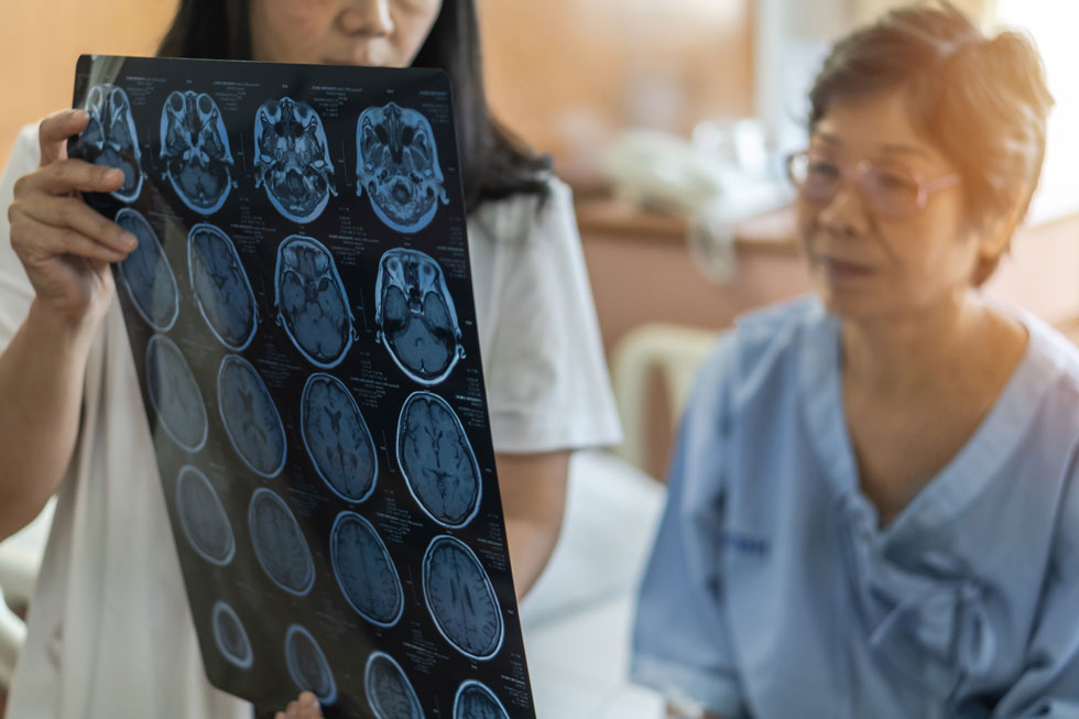 Neurology Asia